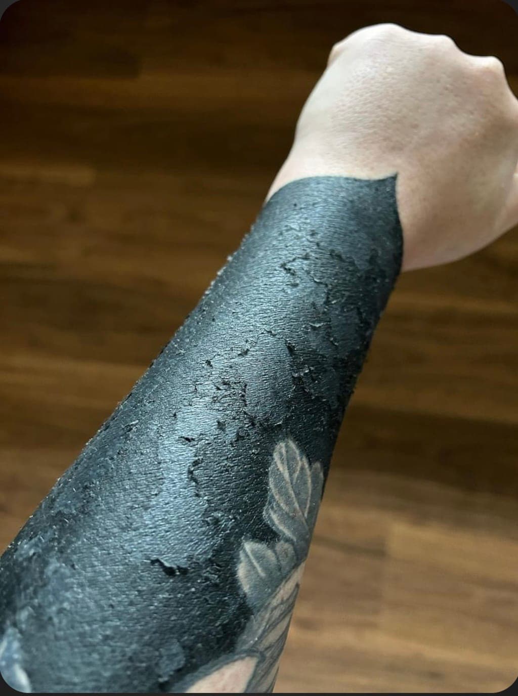 Healing solid black tattoo flaking during peel with a lotus flower visible in negative space
